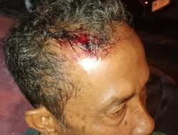 Kepala Di Hantam Pakai Batu, Korban Minta Polisi Segera Tangkap Para Pelaku